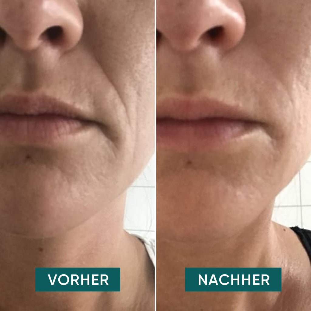 APRICOT Mund Pads mit Hyaluron "I love your smile" · 30 Behandlungen – Bild 6