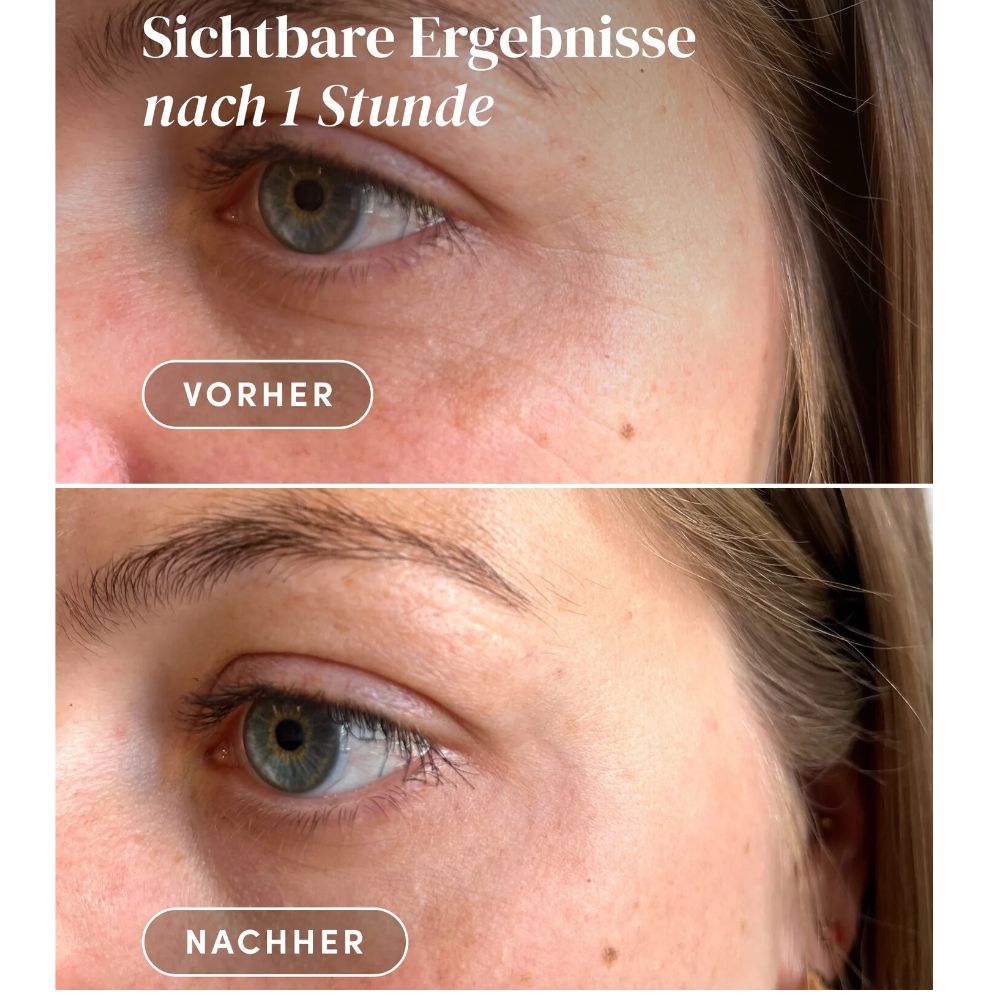 APRICOT Wiederverwendbare Augen-Schläfen Pads mit Hexapeptid · 30 Behandlungen – Bild 4