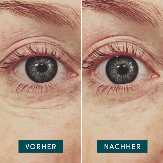 APRICOT Wiederverwendbare Augen Pads mit Hyaluron · 30x wiederverwendbar – Bild 2