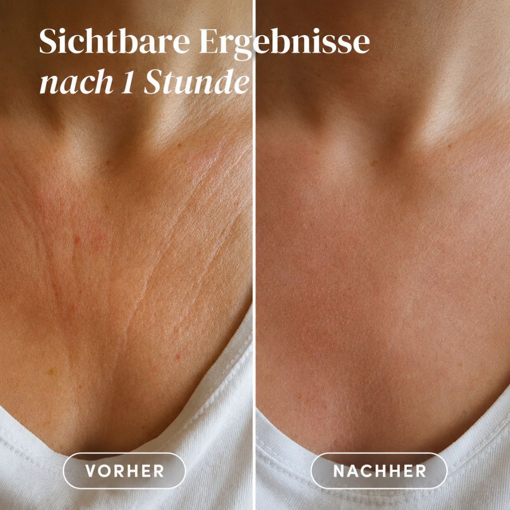 APRICOT | Dekolleté Pflege-Set – Hyaluron Silikonpad + Silikonpad-Reiniger